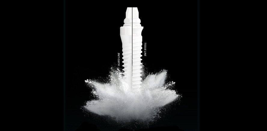 Die neue whiteSKY Alveo Line von bredent: jeden Fall optimal versorgen