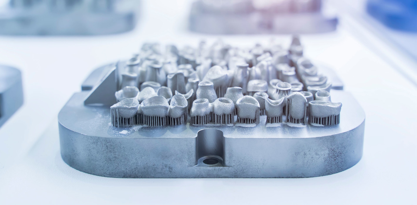 Additive Fertigung in der Dentaltechnologie