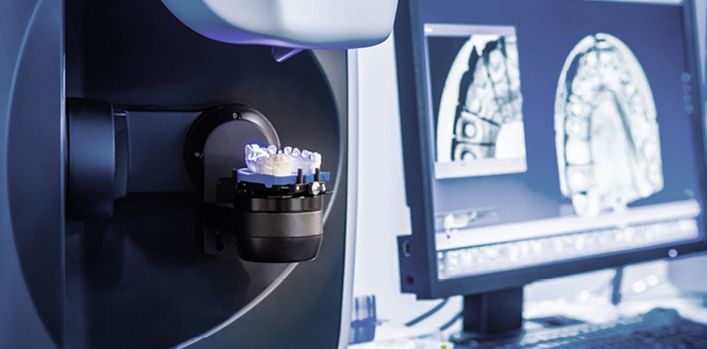 Dentale Teleskoparbeiten: Werkstoffe und Workflow