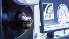 Dentale Teleskoparbeiten: Werkstoffe und Workflow