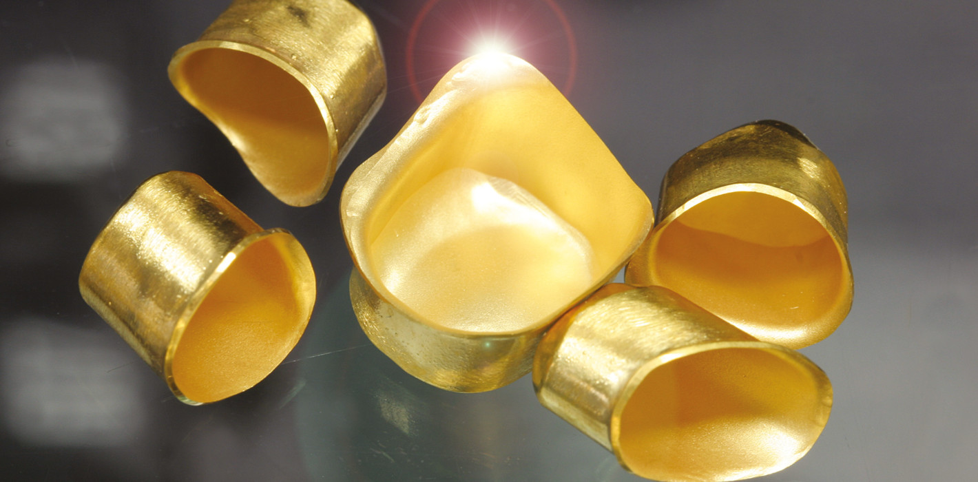 Kein Galvanogerät im eigenen Haus? Galvanoteleskope ganz ohne Equipment?