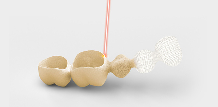 „Gedruckter Goldzahn“: Welche Faktoren sind wichtig?