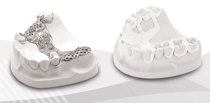 Moderne Zahntechnik: Materialvielfalt im digitalen ­Modellguss