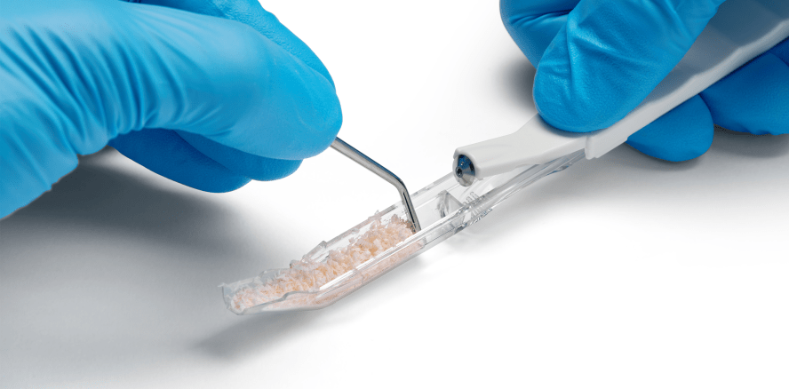 Camlog launcht „Bone Scraper“ zur intraoralen Entnahme autologer Knochenspäne