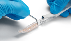 Camlog launcht „Bone Scraper“ zur intraoralen Entnahme autologer Knochenspäne