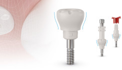 Gingividual® Concept Basic mit scanbaren Gingivaformern & Abformpfosten