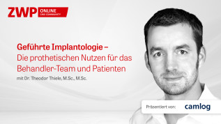 Geführte Implantologie – Die prothetischen Nutzen für das Behandler-Team und Patienten