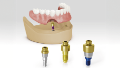 ODSecure® – sichere Prothesenfixierung auf CAMLOG®, CONELOG® und iSy® Implantaten