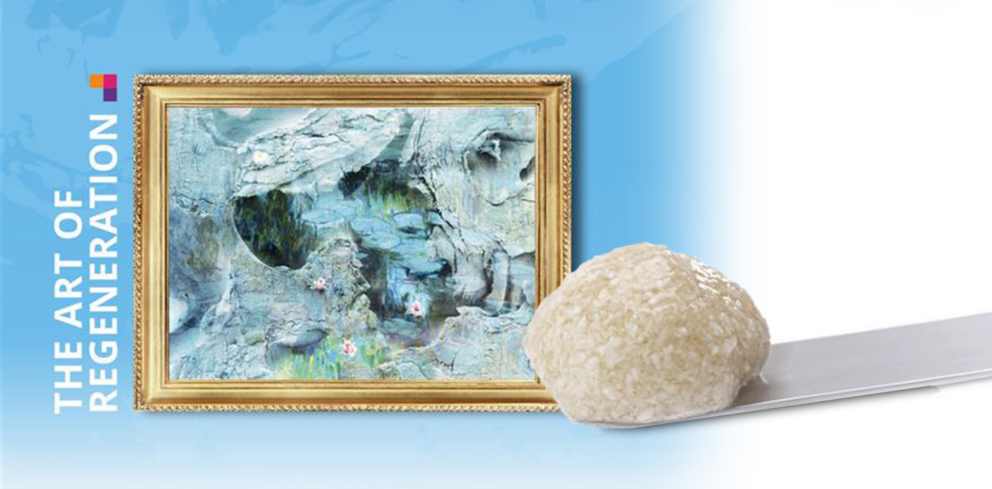Camlog launcht MinerOss® A + HYA: Kombination aus humanem Knochen & Hyaluronsäure
