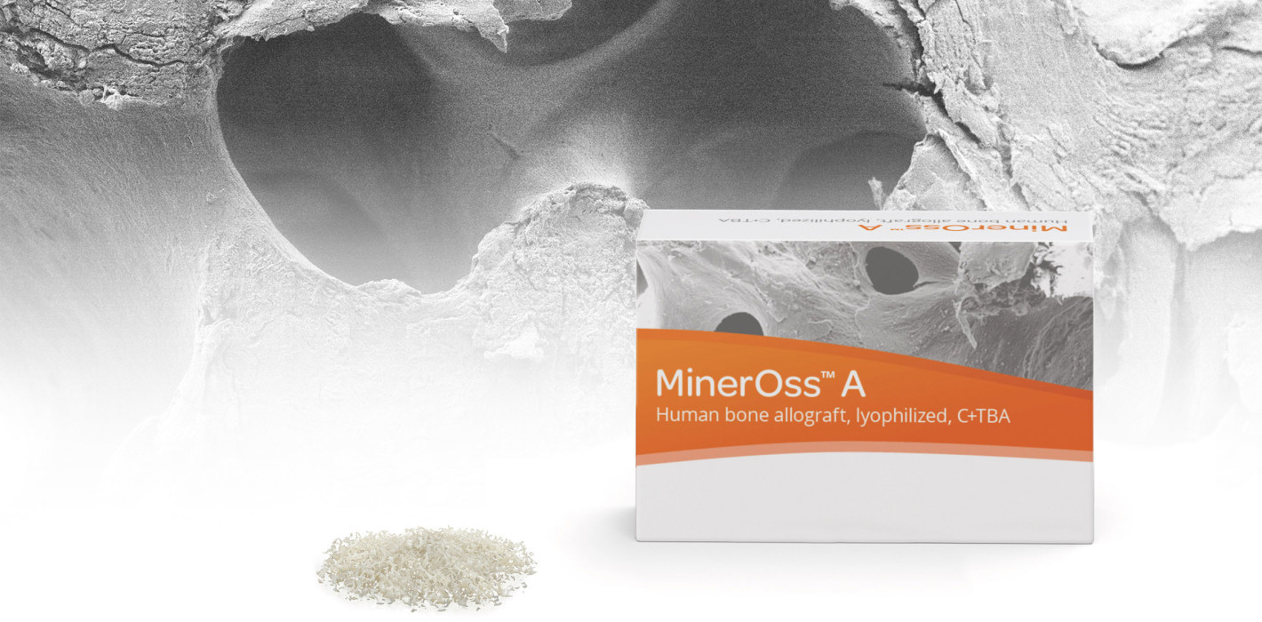 Allogene Produkte ergänzen Biomaterialportfolio