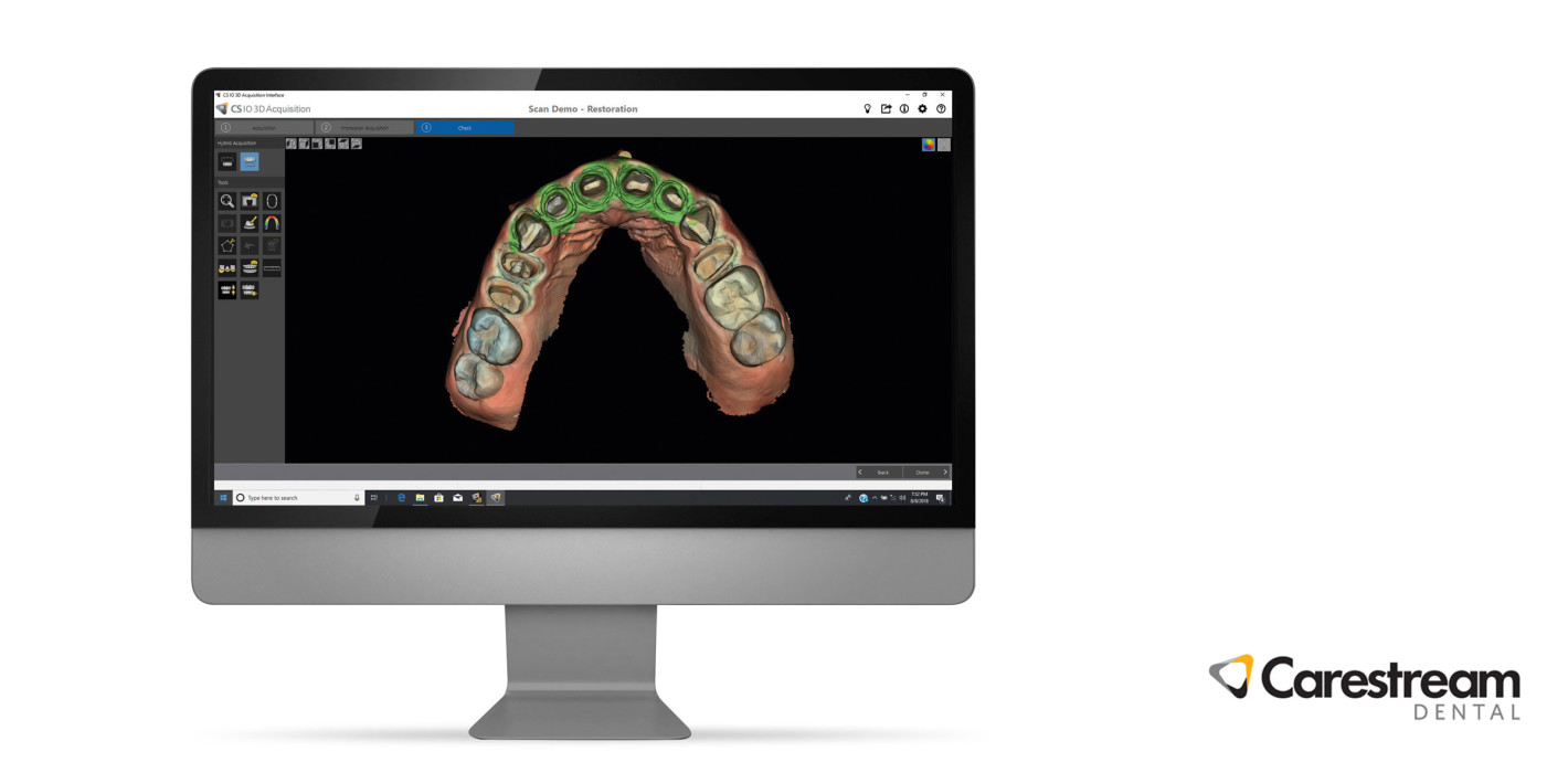 Carestream Dental – CS 3600 jetzt mit neuer Software