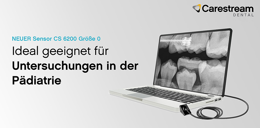 Carestream Dental erweitert Sensorportfolio um den neuen CS 6200 Größe 0