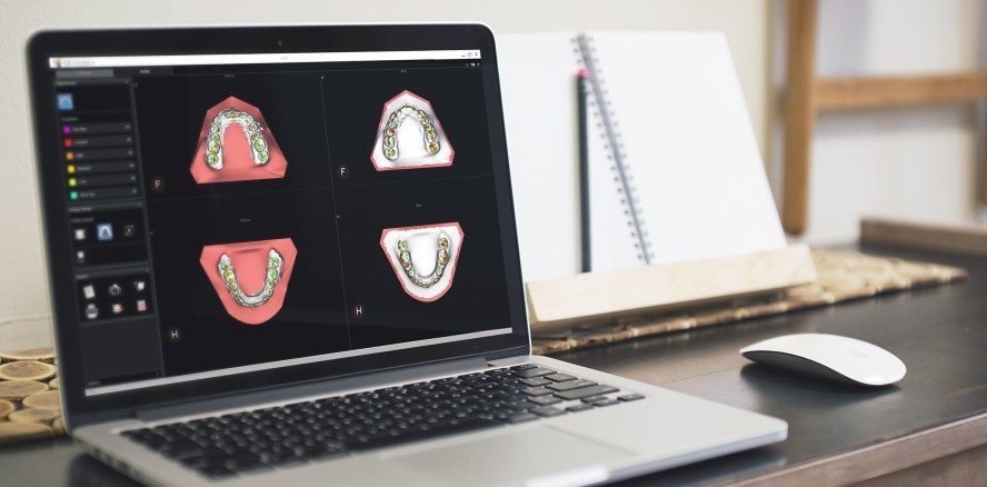 Carestream Dental – Traumpaar CS 3600 und CS Model+