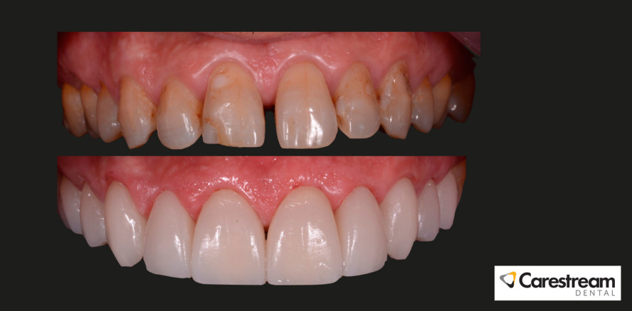 Digitale Dentaltechnologie lässt Patient und Praktiker glücklich lächeln