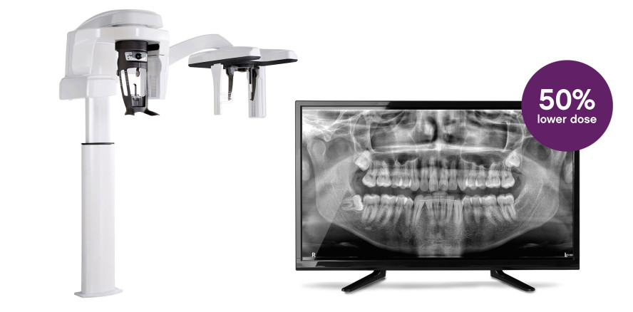 Neo Edition der CS 8200 3D-Familie: präziser DVT jetzt noch intuitiver