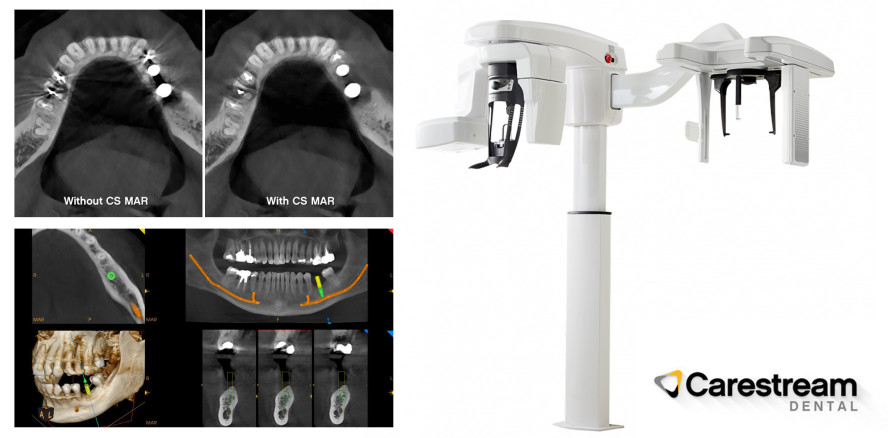 Das CS 8200 3D – ein vielseitiges Multimodalitätssystem