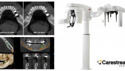 Das CS 8200 3D – ein vielseitiges Multimodalitätssystem