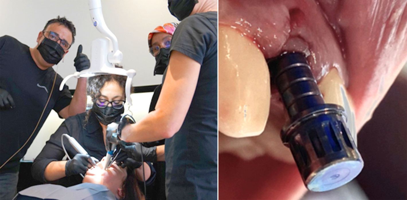 Implantologie-Fortbildungen 2.0 mit Champions-Implants
