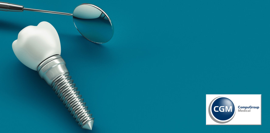 Neue Studie: Früherkennungsdiagnostik macht Zahnimplantate sicher