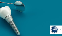 Neue Studie: Früherkennungsdiagnostik macht Zahnimplantate sicher