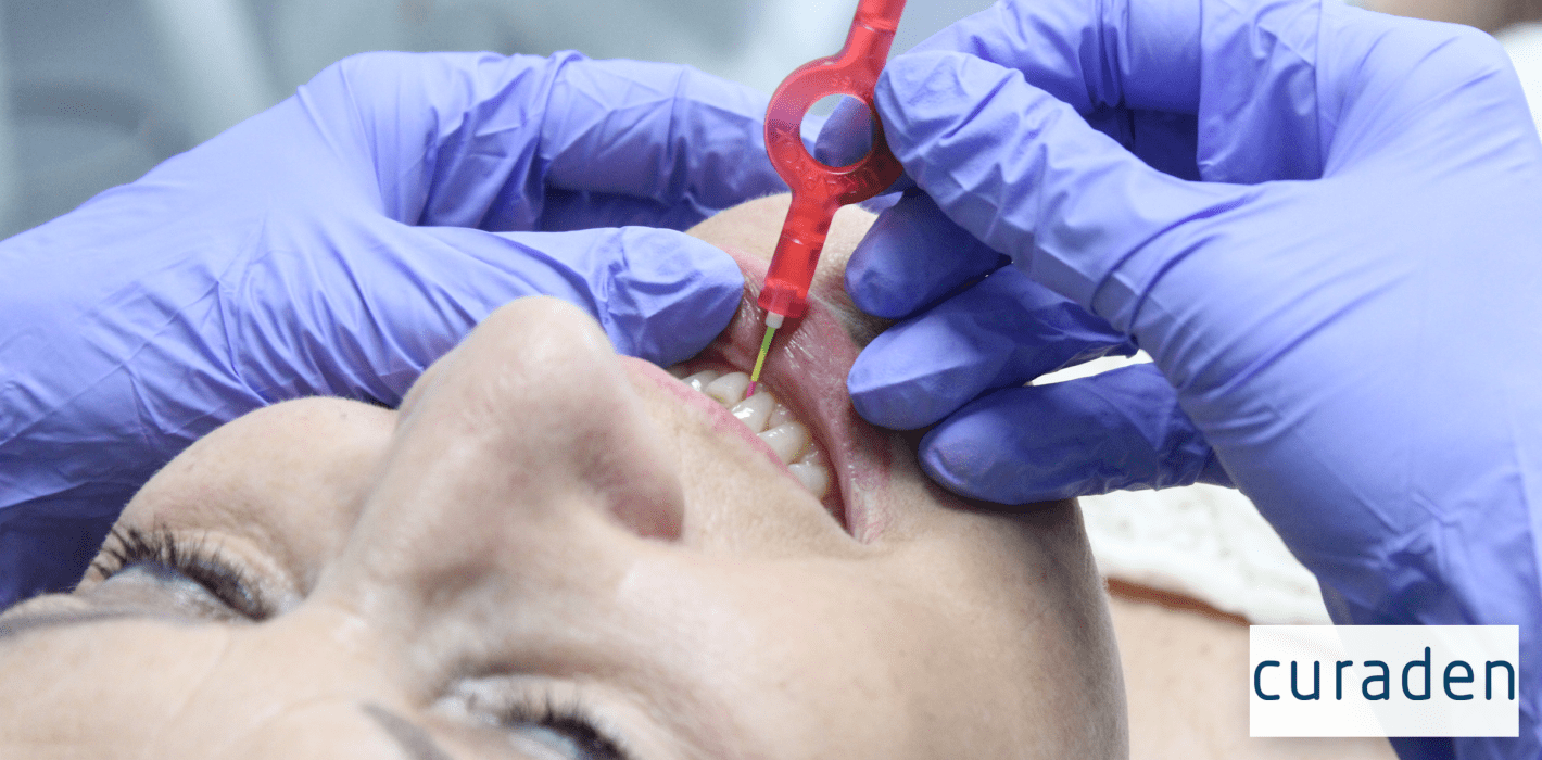 Curaprox: Der Schlüssel zur perfekten Interdentalreinigung