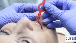 Curaprox: Der Schlüssel zur perfekten Interdentalreinigung