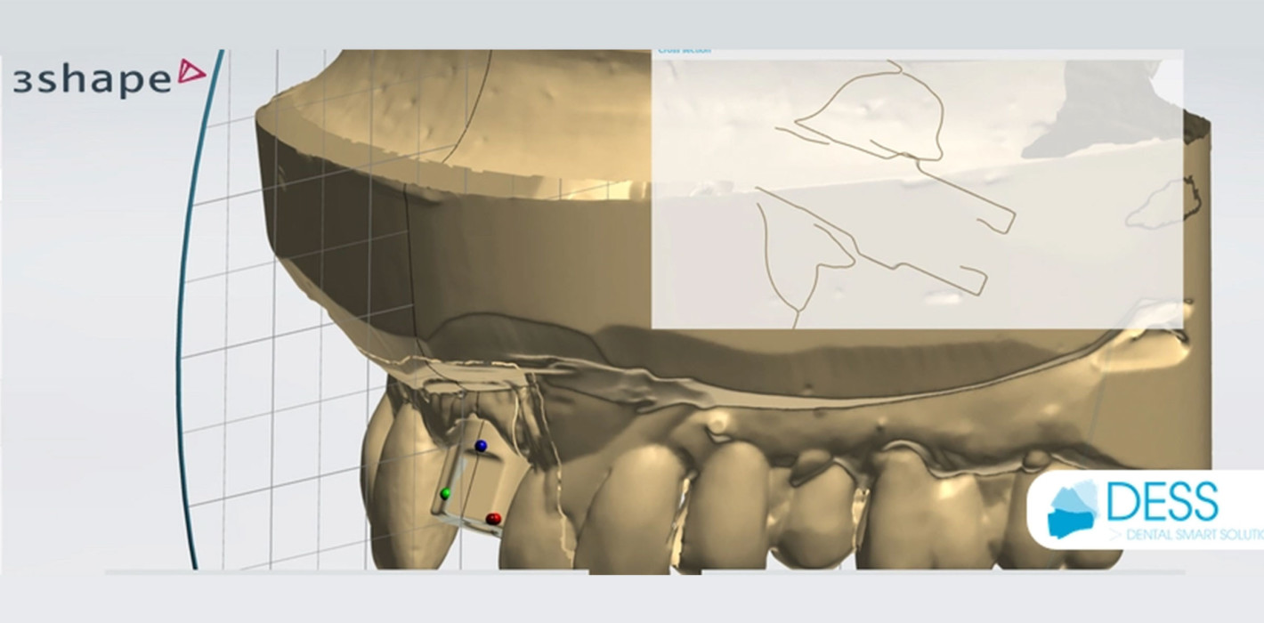 NT-Trading Scankörper für 3Shape DESS Dental Bibliotheken