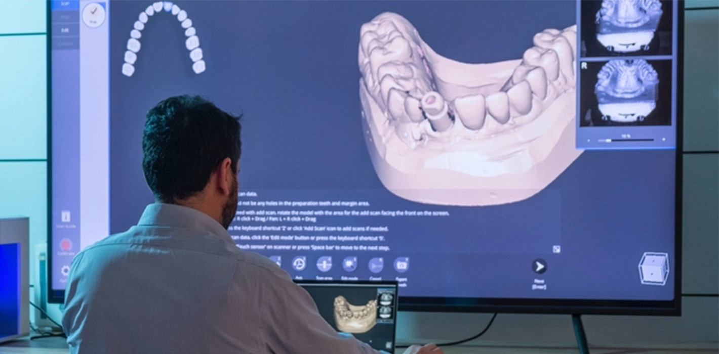 DESS® Dental updated seine 3Shape® Bibliotheken