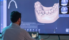 DESS® Dental updated seine 3Shape® Bibliotheken