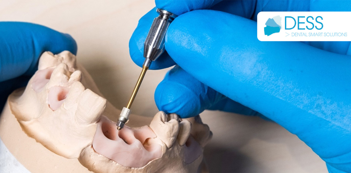 DESS Dental stellt neuen Schraubendreher Griff für Zahnärzte vor