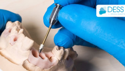 DESS Dental stellt neuen Schraubendreher Griff für Zahnärzte vor