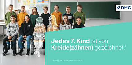 Jedes siebte Kind ist von Kreide(zähnen) gezeichnet