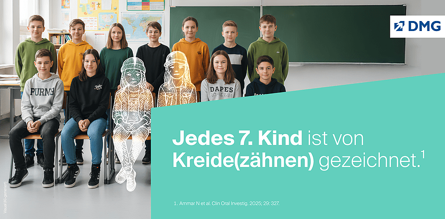 Jedes siebente Kind ist von Kreide(zähnen) gezeichnet
