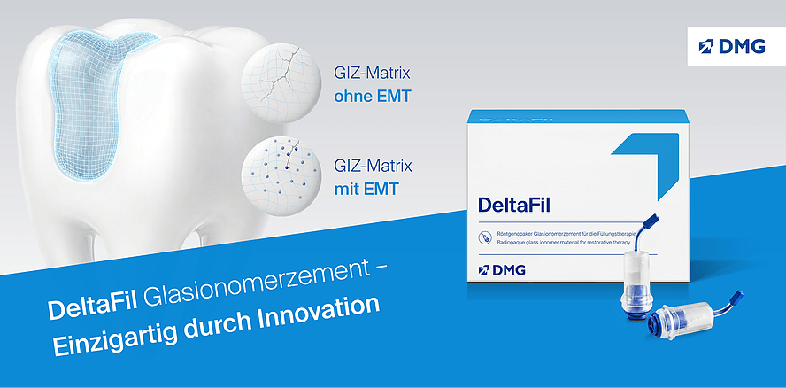 Die GIZ-Innovation – DeltaFil das einzigartige Glasionomerzement von DMG