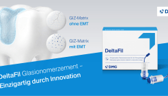 Die GIZ-Innovation – DeltaFil das einzigartige Glasionomerzement von DMG