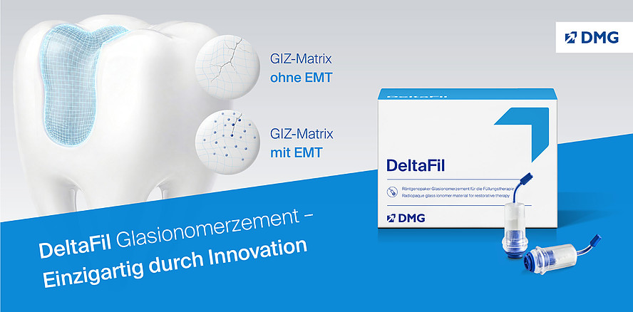 Elastomerische-Mizellen-Technologie: Wie DeltaFil unter Kaubelastung Risse ausbremst