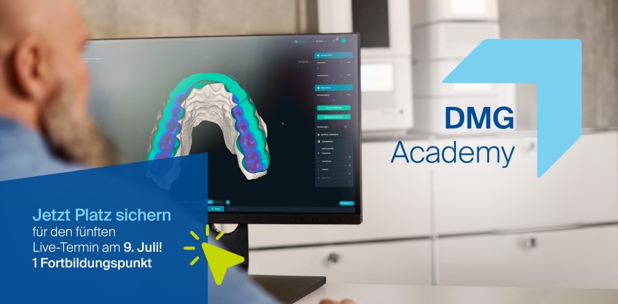 Live am 9.7.: Feinschliff für 3D-gedruckte Aufbissschienen