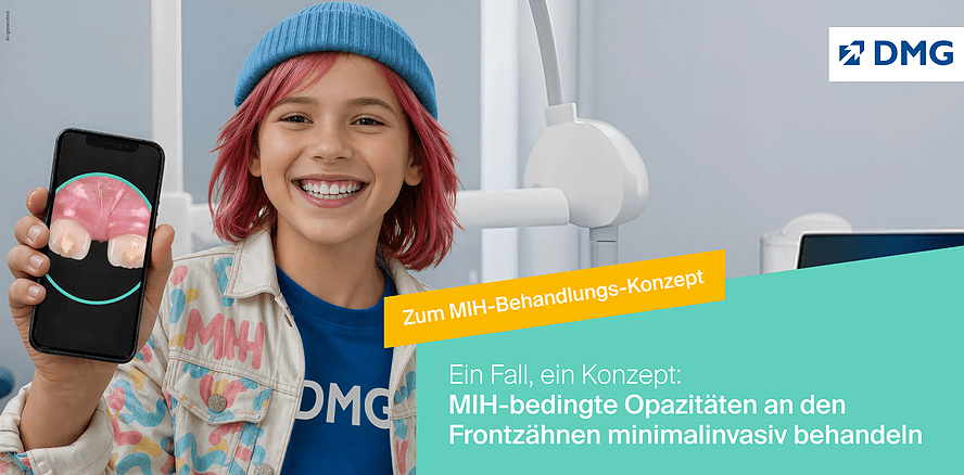 Vom Befund zum Konzept: MIH-bedingte Opazitäten der Frontzähne minimalinvasiv behandeln