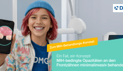 Vom Befund zum Konzept: MIH-bedingte Opazitäten der Frontzähne minimalinvasiv behandeln