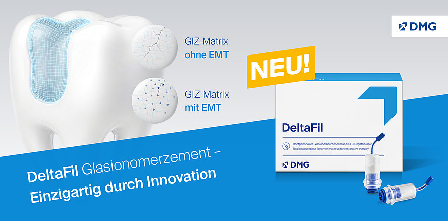 Glasionomerzement DeltaFil von DMG: Bewährt und jetzt noch besser!