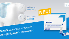 Glasionomerzement DeltaFil von DMG: Bewährt und jetzt noch besser!