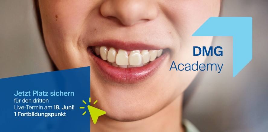 Live am 18.6.: Gamechanger für 3D-gedruckte Aufbissschienen