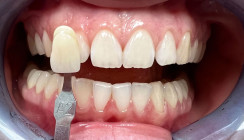 Mit digitalem Teamwork zum dentalen Erfolg
