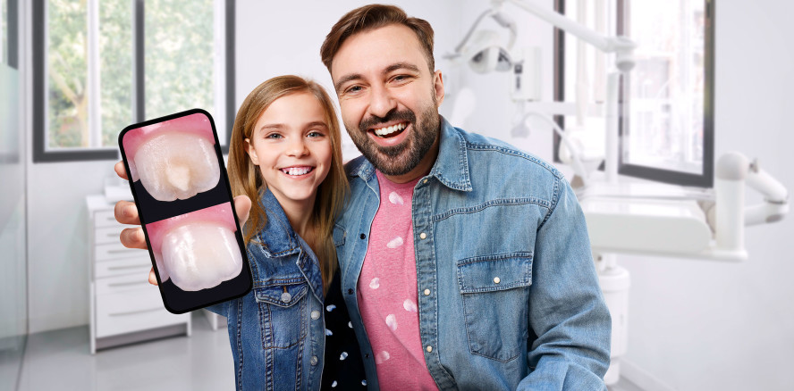 IDS 2025: DMG präsentiert schonende MIH-Behandlung