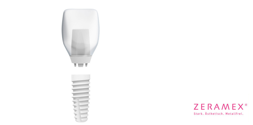 Innovative dentale Implantologie