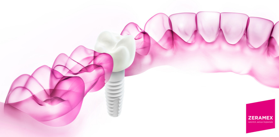 Zeramex mit neuem Markenauftritt
