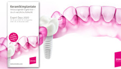 Keramikimplantate im Fokus bei den Zeramex Expert Days 2020