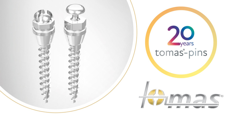 Das tomas® Verankerungssystem wird 20: Ein Grund zum Feiern!