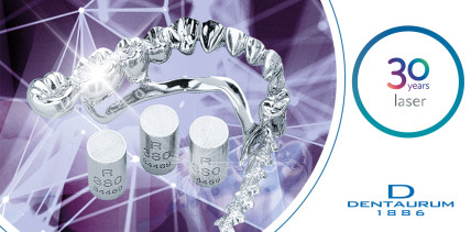 Lasertechnologie bei Dentaurum – 30 Jahre Fortschritt und Innovation