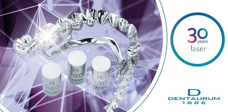 Lasertechnologie bei Dentaurum – 30 Jahre Fortschritt und Innovation